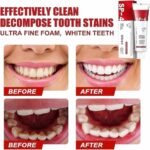 Yayashi SP-4 Ultra Whitening Toothpaste | Stain Remover & Fresh Breath Formula - Image 4