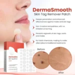DermaSmooth Skin Tag Remover Patch |  Fast, Safe & Painless Skin Tag & Mole Removal | Nano-Microneedle Technology | 72 Patches - Image 3