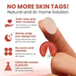 DermaSmooth Skin Tag Remover Patch |  Fast, Safe & Painless Skin Tag & Mole Removal | Nano-Microneedle Technology | 72 Patches - Image 5