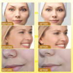 Botox Bee Venom Wrinkle Cream in Pakistan | Anti-Aging & Collagen Boosting Moisturizer - Image 8