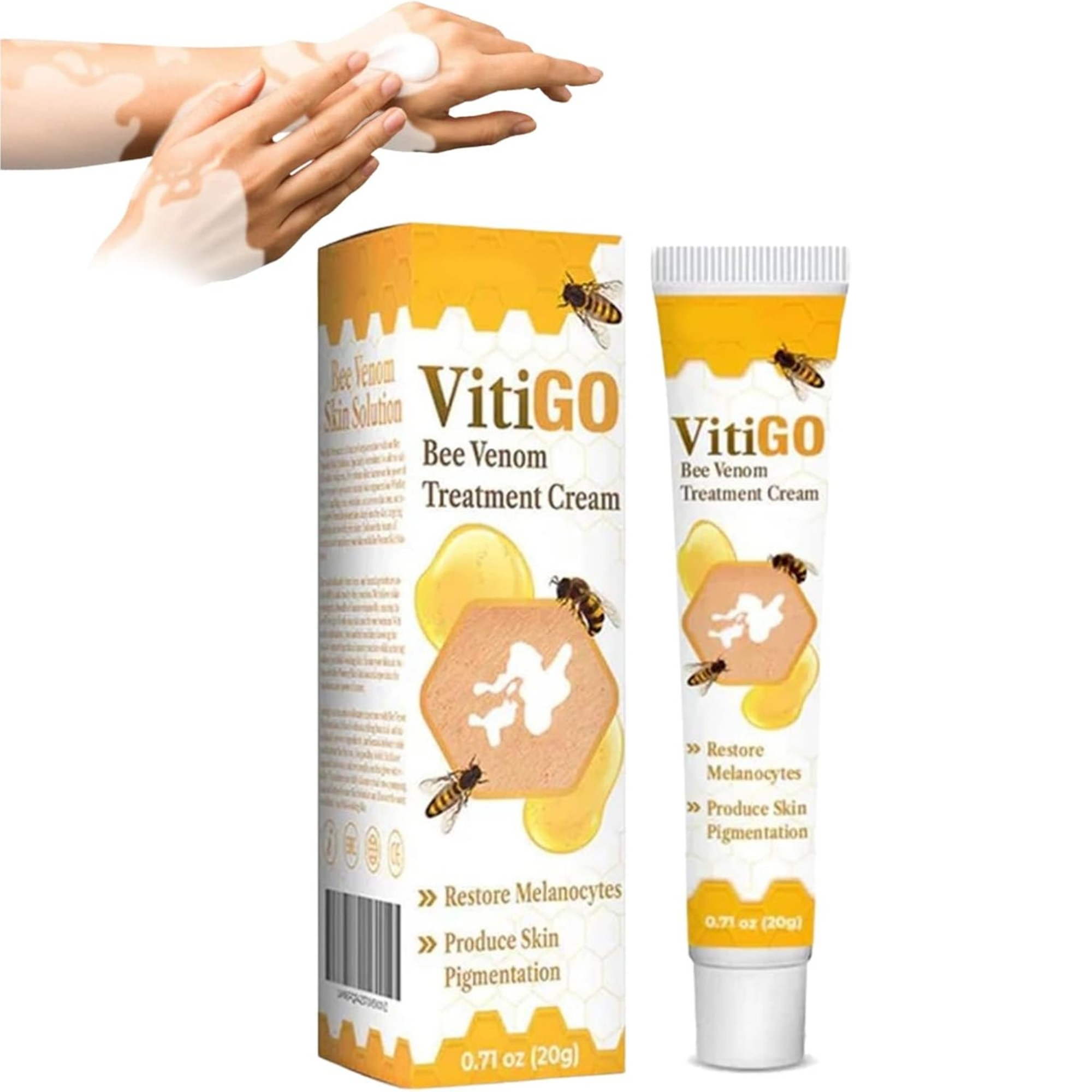 vitigo1_1758004464.jpg Vitigo Bee Venom Treatment Cream | Natural Skin Repair Hydration Relief Anti-Irritation - Image 1