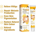 Vitigo Bee Venom Treatment Cream | Natural Skin Repair Hydration Relief Anti-Irritation - Image 2