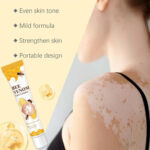 Vitigo Bee Venom Treatment Cream | Natural Skin Repair Hydration Relief Anti-Irritation - Image 6